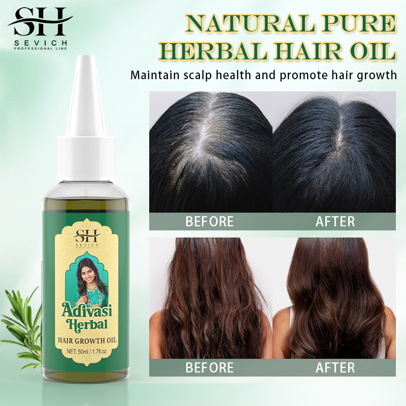 Ayurveda minyak penumbuh rambu - Coconut Oil Refined ulasan dan harga